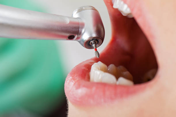 Best Pediatric Emergency Dentist in Leisure Village East, NJ